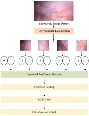 Endoscopic image classification algorithm based on Poolformer